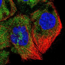 ZNF622 Antibody, Novus Biologicals 0.1mL; Unlabeled:Antibodies, Polyclonal